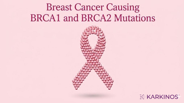 BRCA1 and BRCA2 mutations in breast cancer