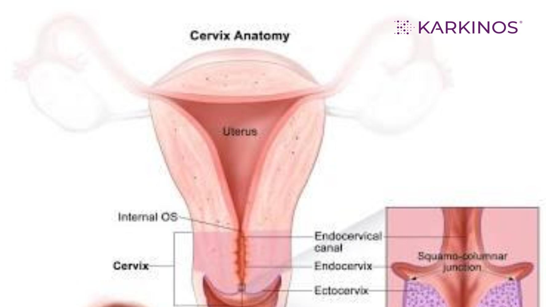 Know the cervix to prevent cervical cancer